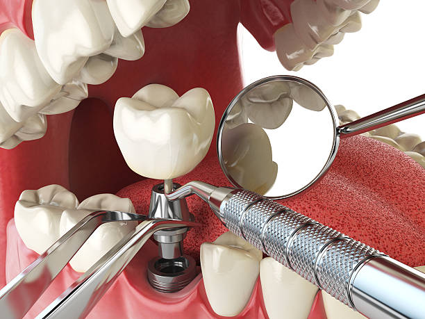 Best Tooth Infection Emergency Dentist  in Newberry, FL