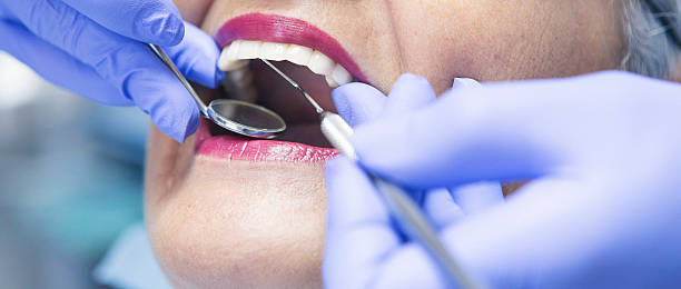 Best Teeth Whitening  in Newberry, FL
